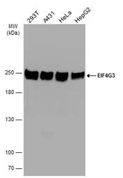 Anti-EIF4G3 antibody [N1], N-term used in Western Blot (WB). GTX118109