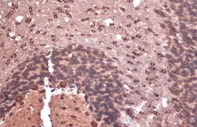 Anti-EIF4G3 antibody [N1], N-term used in IHC (Paraffin sections) (IHC-P). GTX118109