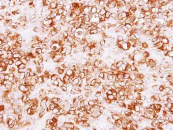 Anti-Calpain S1 antibody used in IHC (Paraffin sections) (IHC-P). GTX118130