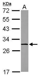 Anti-Calpain S1 antibody used in Western Blot (WB). GTX118130