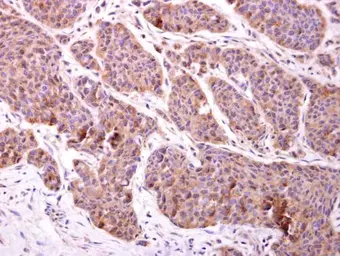Anti-CHMP2B antibody used in IHC (Paraffin sections) (IHC-P). GTX118181