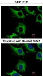 Anti-CHMP2B antibody used in Immunocytochemistry/ Immunofluorescence (ICC/IF). GTX118181