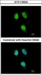 Anti-PPIH antibody used in Immunocytochemistry/ Immunofluorescence (ICC/IF). GTX118224