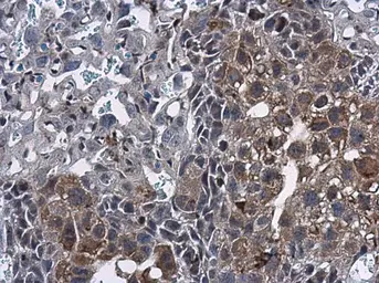 Anti-Mig-6 antibody [N1C1] used in IHC (Paraffin sections) (IHC-P). GTX118238