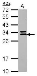 Anti-CNOT7 antibody [N1C1] used in Western Blot (WB). GTX118241