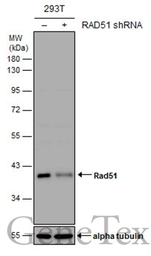 Anti-Rad51 antibody used in Western Blot (WB). GTX118249
