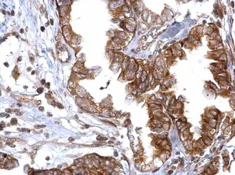 Anti-Rad51 antibody used in IHC (Paraffin sections) (IHC-P). GTX118249