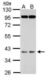 Anti-FBXO28 antibody used in Western Blot (WB). GTX118254