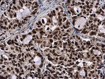 Anti-SMNDC1 antibody [N1C3-2] used in IHC (Paraffin sections) (IHC-P). GTX118263