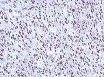 Anti-SMNDC1 antibody [N1C3-2] used in IHC (Paraffin sections) (IHC-P). GTX118263
