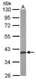 Anti-CRYZ antibody [N1C1] used in Western Blot (WB). GTX118270