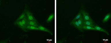 Anti-Tub antibody used in Immunocytochemistry/ Immunofluorescence (ICC/IF). GTX118348