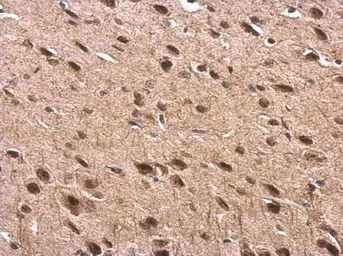 Anti-Tub antibody used in IHC (Paraffin sections) (IHC-P). GTX118348
