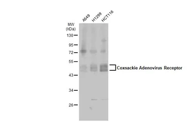 Anti-Coxsackie Adenovirus Receptor antibody used in Western Blot (WB). GTX118382