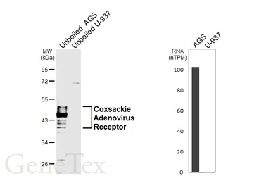 Anti-Coxsackie Adenovirus Receptor antibody used in Western Blot (WB). GTX118382