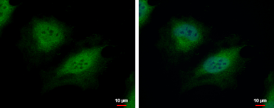 Anti-CSRP2BP antibody [N1N3] used in Immunocytochemistry/ Immunofluorescence (ICC/IF). GTX118397