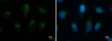 Anti-TMF1 antibody used in Immunocytochemistry/ Immunofluorescence (ICC/IF). GTX118431