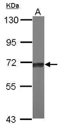 Anti-TKTL2 antibody [N1N3] used in Western Blot (WB). GTX118468