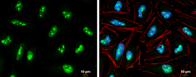 Anti-EXOSC5 antibody used in Immunocytochemistry/ Immunofluorescence (ICC/IF). GTX118473
