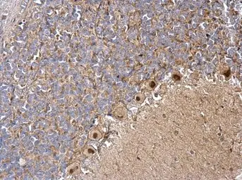 Anti-DBC1 antibody [N1N2], N-term used in IHC (Paraffin sections) (IHC-P). GTX118477