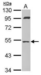 Anti-SAMM50 antibody [N1C1] used in Western Blot (WB). GTX118528