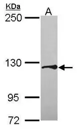 Anti-Tomosyn antibody [N1N2-2], N-term used in Western Blot (WB). GTX118539