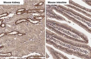 Anti-SNX5 antibody [N2C2], Internal used in IHC (Paraffin sections) (IHC-P). GTX118542
