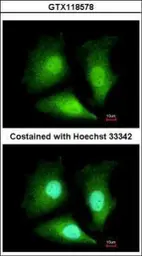 Anti-ADI1 antibody used in Immunocytochemistry/ Immunofluorescence (ICC/IF). GTX118578