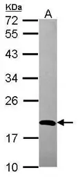 Anti-ADI1 antibody used in Western Blot (WB). GTX118578