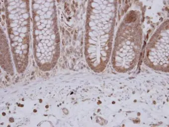 Anti-GTPBP9 antibody [N1C1] used in IHC (Paraffin sections) (IHC-P). GTX118604
