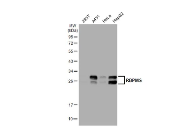 Anti-RBPMS antibody used in Western Blot (WB). GTX118619