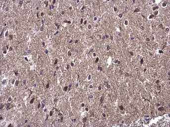Anti-WBP11 antibody used in IHC (Paraffin sections) (IHC-P). GTX118654