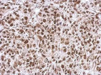 Anti-WBP11 antibody used in IHC (Paraffin sections) (IHC-P). GTX118654