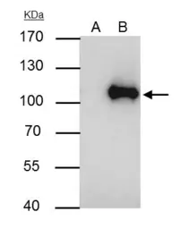 Anti-WBP11 antibody used in Immunoprecipitation (IP). GTX118654