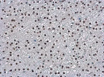 Anti-WBP11 antibody used in IHC (Paraffin sections) (IHC-P). GTX118654