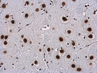 Anti-WBP11 antibody used in IHC (Paraffin sections) (IHC-P). GTX118654