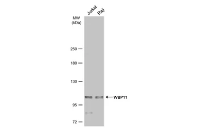 Anti-WBP11 antibody used in Western Blot (WB). GTX118654