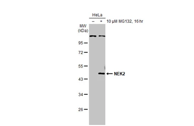 Anti-NEK2 antibody used in Western Blot (WB). GTX118735