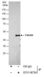 Anti-TSG101 antibody used in Immunoprecipitation (IP). GTX118736