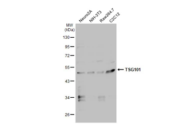 Anti-TSG101 antibody used in Western Blot (WB). GTX118736