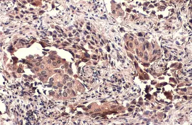 Anti-TSG101 antibody used in IHC (Paraffin sections) (IHC-P). GTX118736