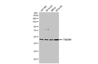 Anti-TSG101 antibody used in Western Blot (WB). GTX118736