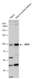 Anti-BRD7 antibody [C1C3] used in Western Blot (WB). GTX118755