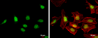 Anti-BRD7 antibody [C1C3] used in Immunocytochemistry/ Immunofluorescence (ICC/IF). GTX118755
