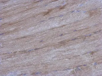Anti-IVNS1ABP antibody used in IHC (Paraffin sections) (IHC-P). GTX118817