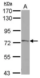 Anti-IVNS1ABP antibody used in Western Blot (WB). GTX118817