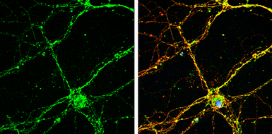 Anti-RAB26 antibody [N2C3-2] used in Immunocytochemistry/ Immunofluorescence (ICC/IF). GTX118872