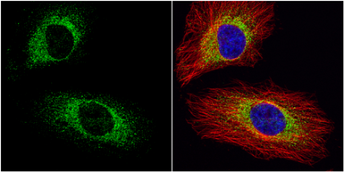 Anti-EIF3A antibody [N1N2], N-term used in Immunocytochemistry/ Immunofluorescence (ICC/IF). GTX118895