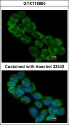 Anti-EIF3A antibody [N1N2], N-term used in Immunocytochemistry/ Immunofluorescence (ICC/IF). GTX118895