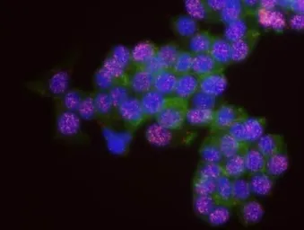 Anti-DNMT1 antibody used in Proximity ligation assay (PLA). GTX11891